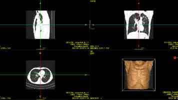 攻防演练：从容应对花式爬虫的后端架构实战指南